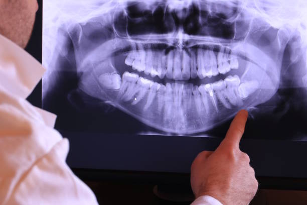Best Tooth Infection Emergency Dentist  in Inman, SC