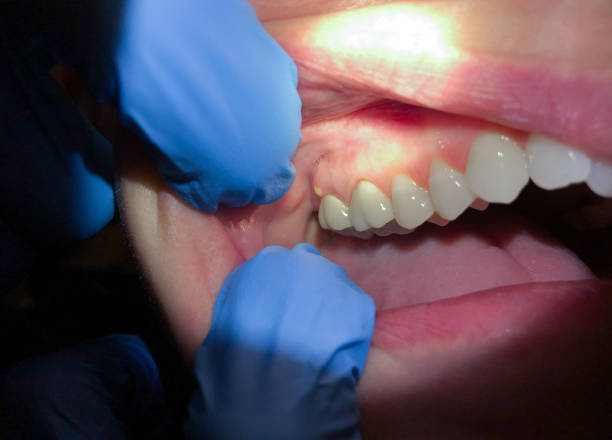 Best Knocked-Out Tooth Emergency  in Inman, SC